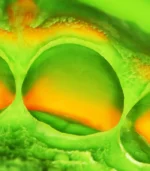 estructura implante dental