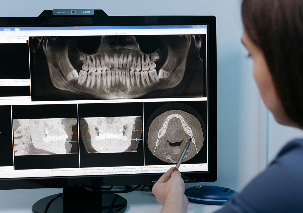 Tendencias en biomateriales odontológicos | Suministros Dentales