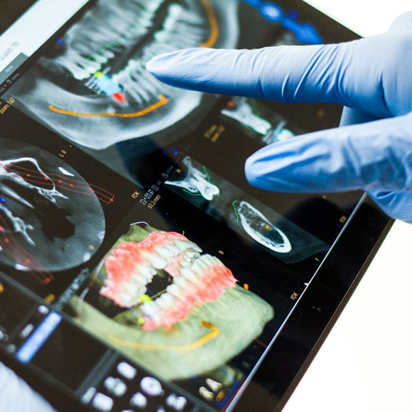 Biomateriales Dentales | Innovación en regeneración ósea y tejidos