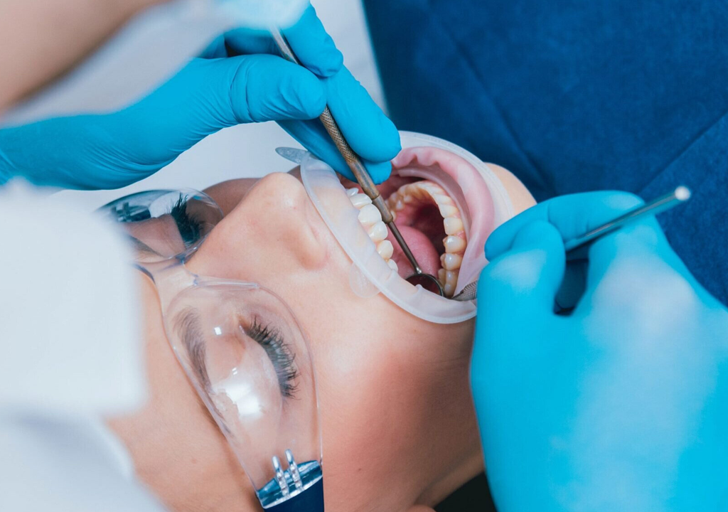 Periostótomo en cirugía oral: usos, tipos y recomendaciones