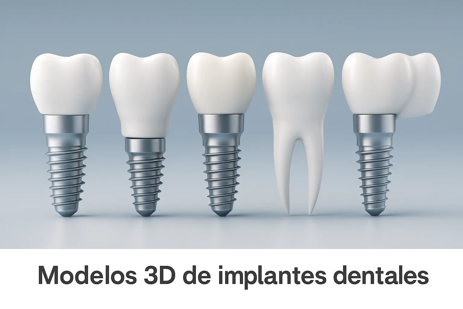 Modelos 3D de implantes dentales en diferentes formas y tamaños